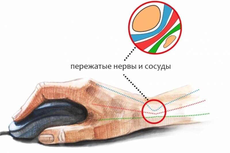 Кракен это даркнет маркетплейс